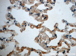 Napsin A Antibody in Immunohistochemistry (Paraffin) (IHC (P))