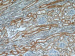 Napsin A Antibody in Immunohistochemistry (Paraffin) (IHC (P))