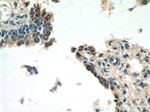 Napsin A Antibody in Immunohistochemistry (Paraffin) (IHC (P))