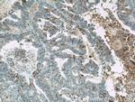 MUC16/CA125 Antibody in Immunohistochemistry (Paraffin) (IHC (P))