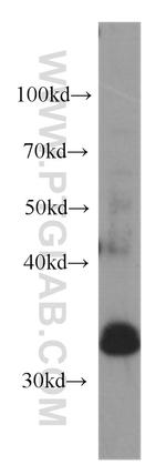 MEST Antibody in Western Blot (WB)