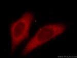 CCT3 Antibody in Immunocytochemistry (ICC/IF)