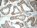 CCT3 Antibody in Immunohistochemistry (Paraffin) (IHC (P))