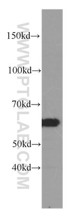 CCT3 Antibody in Western Blot (WB)