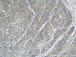 CCT3 Antibody in Immunohistochemistry (Paraffin) (IHC (P))