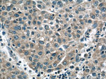 CCT3 Antibody in Immunohistochemistry (Paraffin) (IHC (P))
