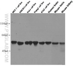 PKM2 Antibody in Western Blot (WB)