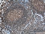 CD20 Antibody in Immunohistochemistry (Paraffin) (IHC (P))