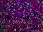 CD20 Antibody in Immunohistochemistry (PFA fixed) (IHC (PFA))