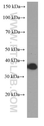 CD20 Antibody in Western Blot (WB)