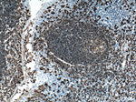 CD20 Antibody in Immunohistochemistry (Paraffin) (IHC (P))
