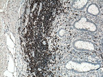 CD20 Antibody in Immunohistochemistry (Paraffin) (IHC (P))