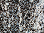 CD20 Antibody in Immunohistochemistry (Paraffin) (IHC (P))