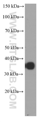 CD20 Antibody in Western Blot (WB)