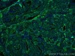 Thyroglobulin Antibody in Immunohistochemistry (PFA fixed) (IHC (PFA))