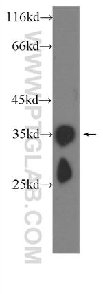 CRYBB1 Antibody in Western Blot (WB)