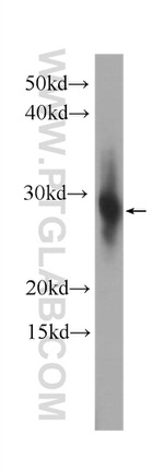 CRYBB1 Antibody in Western Blot (WB)
