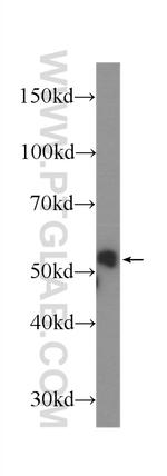 Cytokeratin 8 Antibody in Western Blot (WB)