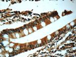 Chk1 Antibody in Immunohistochemistry (Paraffin) (IHC (P))