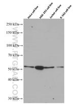Chk1 Antibody in Western Blot (WB)