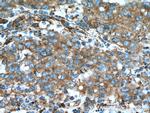 SECTM1 Antibody in Immunohistochemistry (Paraffin) (IHC (P))