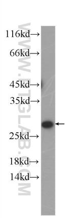 SECTM1 Antibody in Western Blot (WB)