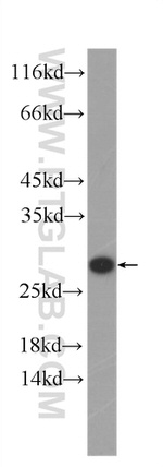 SECTM1 Antibody in Western Blot (WB)