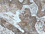 FAM3C Antibody in Immunohistochemistry (Paraffin) (IHC (P))