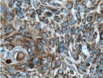 FAM3C Antibody in Immunohistochemistry (Paraffin) (IHC (P))