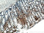 CD45 Antibody in Immunohistochemistry (Paraffin) (IHC (P))