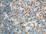 CD45 Antibody in Immunohistochemistry (Paraffin) (IHC (P))
