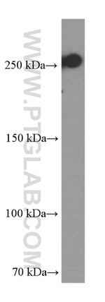 CD45 Antibody in Western Blot (WB)