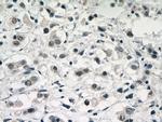 U2AF35 Antibody in Immunohistochemistry (Paraffin) (IHC (P))