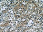 RBM4 Antibody in Immunohistochemistry (Paraffin) (IHC (P))