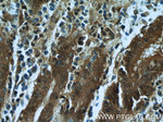 RBM4 Antibody in Immunohistochemistry (Paraffin) (IHC (P))