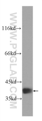 RBM4 Antibody in Western Blot (WB)