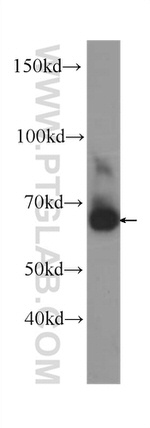 PLAP Antibody in Western Blot (WB)
