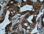 IL37 Antibody in Immunohistochemistry (Paraffin) (IHC (P))