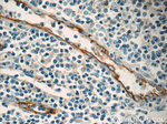ICAM-1 Antibody in Immunohistochemistry (Paraffin) (IHC (P))