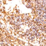CD8 Antibody in Immunohistochemistry (Paraffin) (IHC (P))