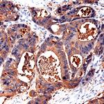 CEA Antibody in Immunohistochemistry (Paraffin) (IHC (P))
