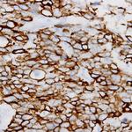 Beta-Tubulin III Antibody in Immunohistochemistry (Paraffin) (IHC (P))