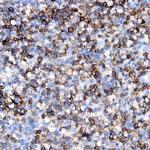 Kappa Light Chain Antibody in Immunohistochemistry (Paraffin) (IHC (P))