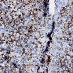 Kappa Light Chain Antibody in Immunohistochemistry (Paraffin) (IHC (P))