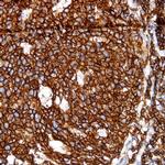 CD45 (Leukocyte common antigen, LCA) Antibody in Immunohistochemistry (Paraffin) (IHC (P))