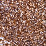 CD45 (Leukocyte common antigen, LCA) Antibody in Immunohistochemistry (Paraffin) (IHC (P))