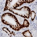 Estrogen Receptor, alpha (ER alpha) Antibody in Immunohistochemistry (Paraffin) (IHC (P))