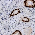 Estrogen Receptor, beta (ER beta) Antibody in Immunohistochemistry (Paraffin) (IHC (P))
