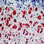 Multi-Drug Resistance Marker (P-Glycoprotein) Antibody in Immunohistochemistry (Paraffin) (IHC (P))