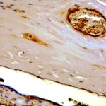 hCG a-subunit Antibody in Immunohistochemistry (Paraffin) (IHC (P))